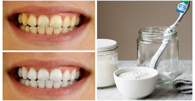 6 Ways to Prevent Coffee Stains on Teeth