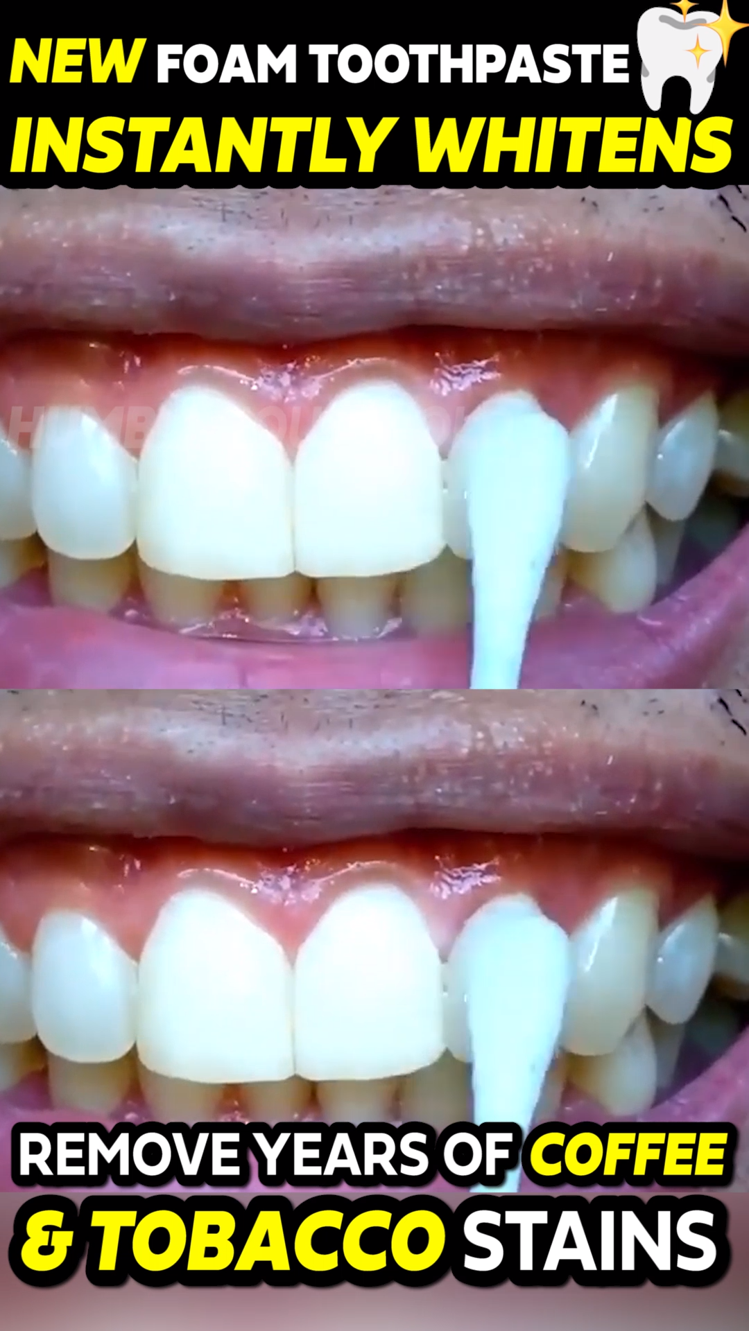 How To Remove Coffee Stains From Teeth Quickly